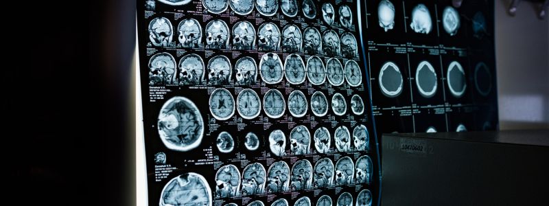 What’s New at Our Imaging Center?